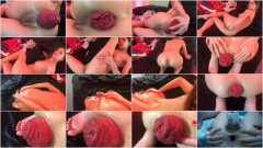 Maria Hella Extract show incredible prolapse | Download from Files Monster